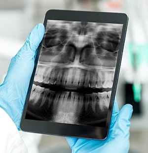 digital x-ray on tablet